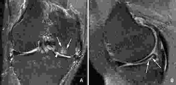 MRI And X Ray Scans Of Hip And Knee Joints, Highlighting Potential Abnormalities. Hip And Knee Pain DisFree Downloads: An Evidence Informed And Clinical Based Approach Integrating Manual Therapy And Exercise